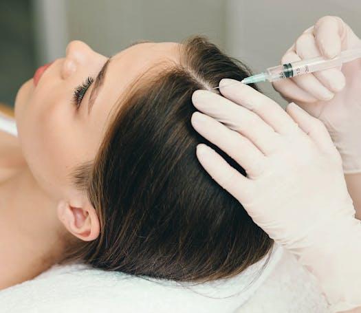 Une femme a un traitement par injection de mésothérapie pour le cuir cheveux